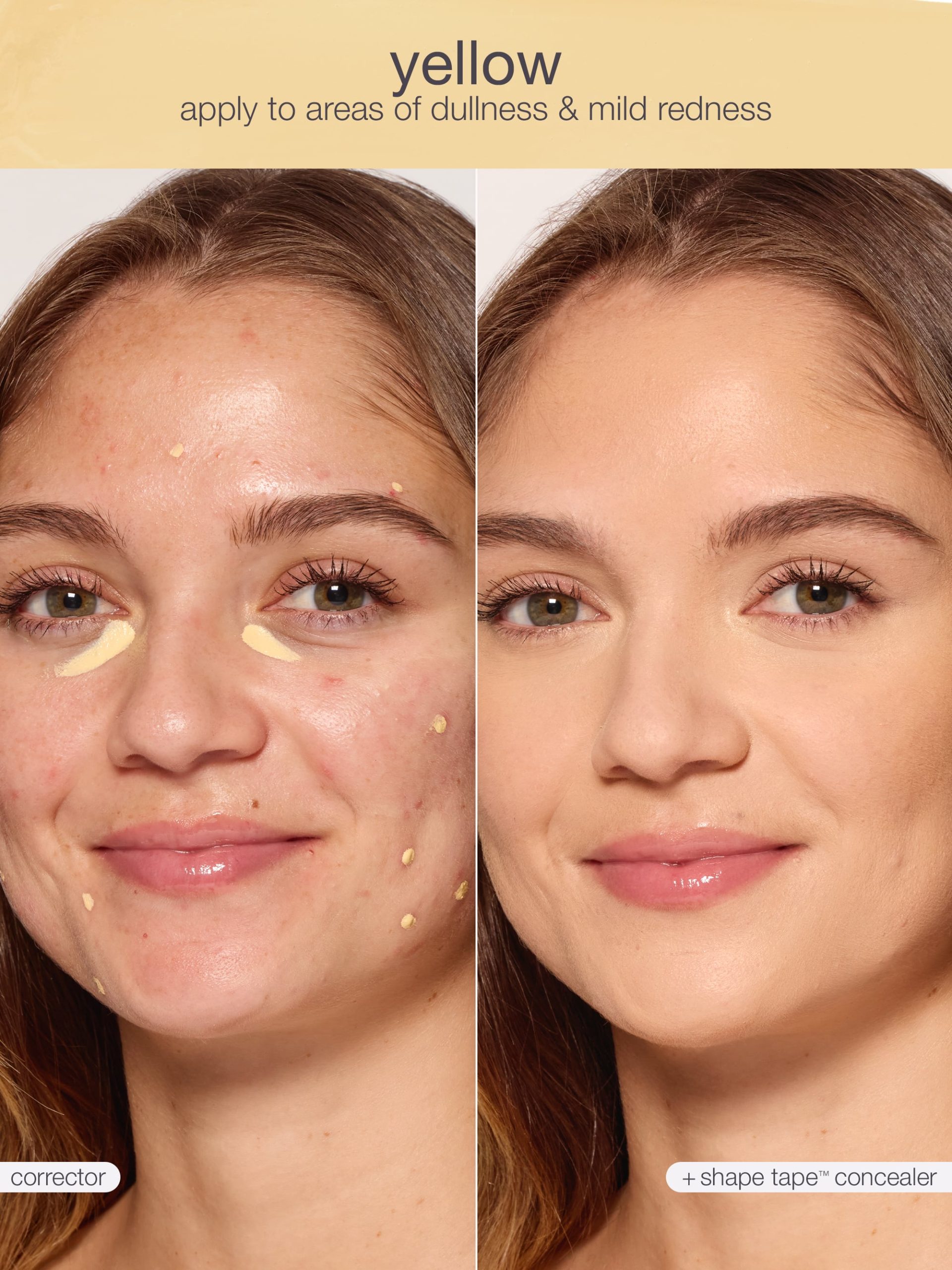 unique__846733095520__shape-tape-corrector-yellow__02.jpg